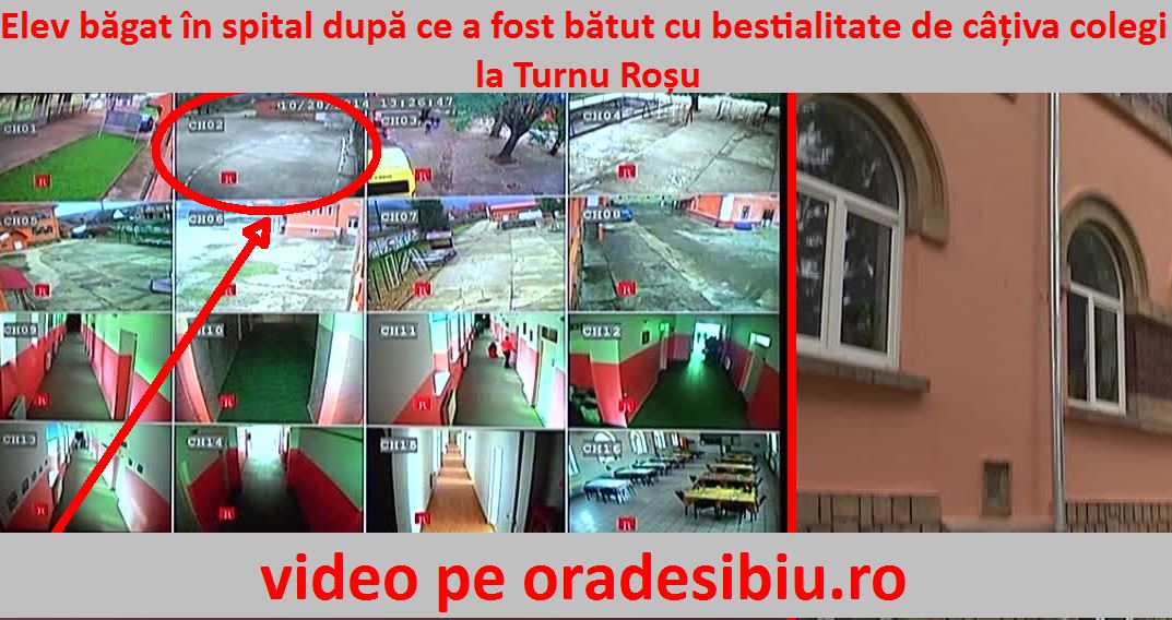 video elev băgat în spital după ce a fost bătut cu bestialitate de câțiva colegi la turnu roșu