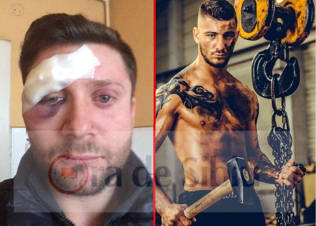 crăciun însângerat – doi sibieni susțin că au fost bătuți de luptătorul de mma, vasinca andrei: ”nu i-am făcut nimic!” (foto)