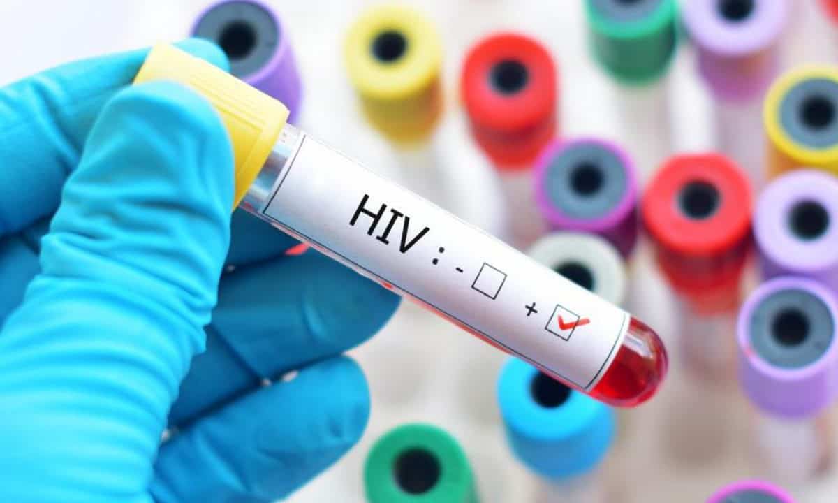 Variantă virulentă a HIV descoperită în Olanda