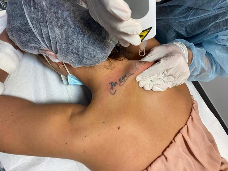 Tatuaje regretate de sibieni - „O călugăriță a venit să își scoată un tatuaj care se întindea pe jumătate de braț”