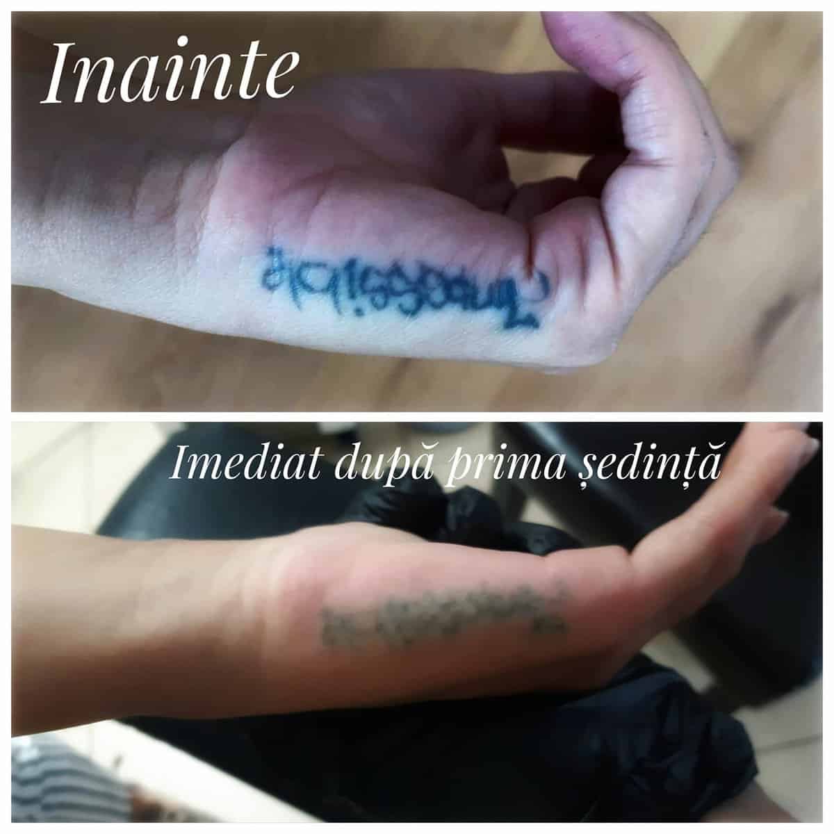 tatuaje regretate de sibieni - „o călugăriță a venit să își scoată un tatuaj care se întindea pe jumătate de braț”