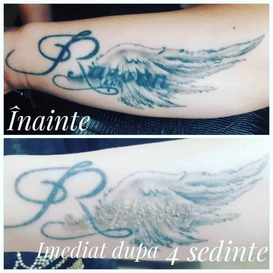 tatuaje regretate de sibieni - „o călugăriță a venit să își scoată un tatuaj care se întindea pe jumătate de braț”