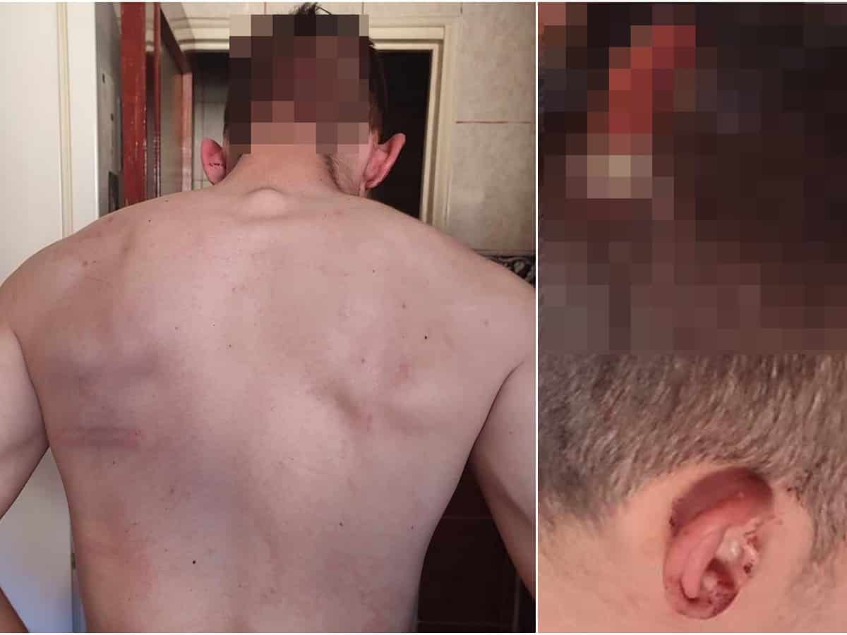 Un tânăr din Sibiu acuză că a fost bătut de un polițist. Șeful IPJ: Se fac cercetări pentru ultraj (foto)