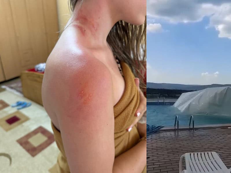 tânără la un pas de moarte după ce un cort de evenimente s-a răsturnat peste ea în timp ce se relaxa în piscina unei pensiuni din județul sibiu (video foto)