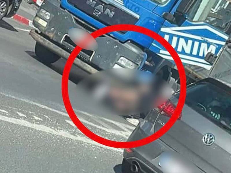 starea femeii rănite în accidentul de miercuri de pe bulevardul mihai viteazu